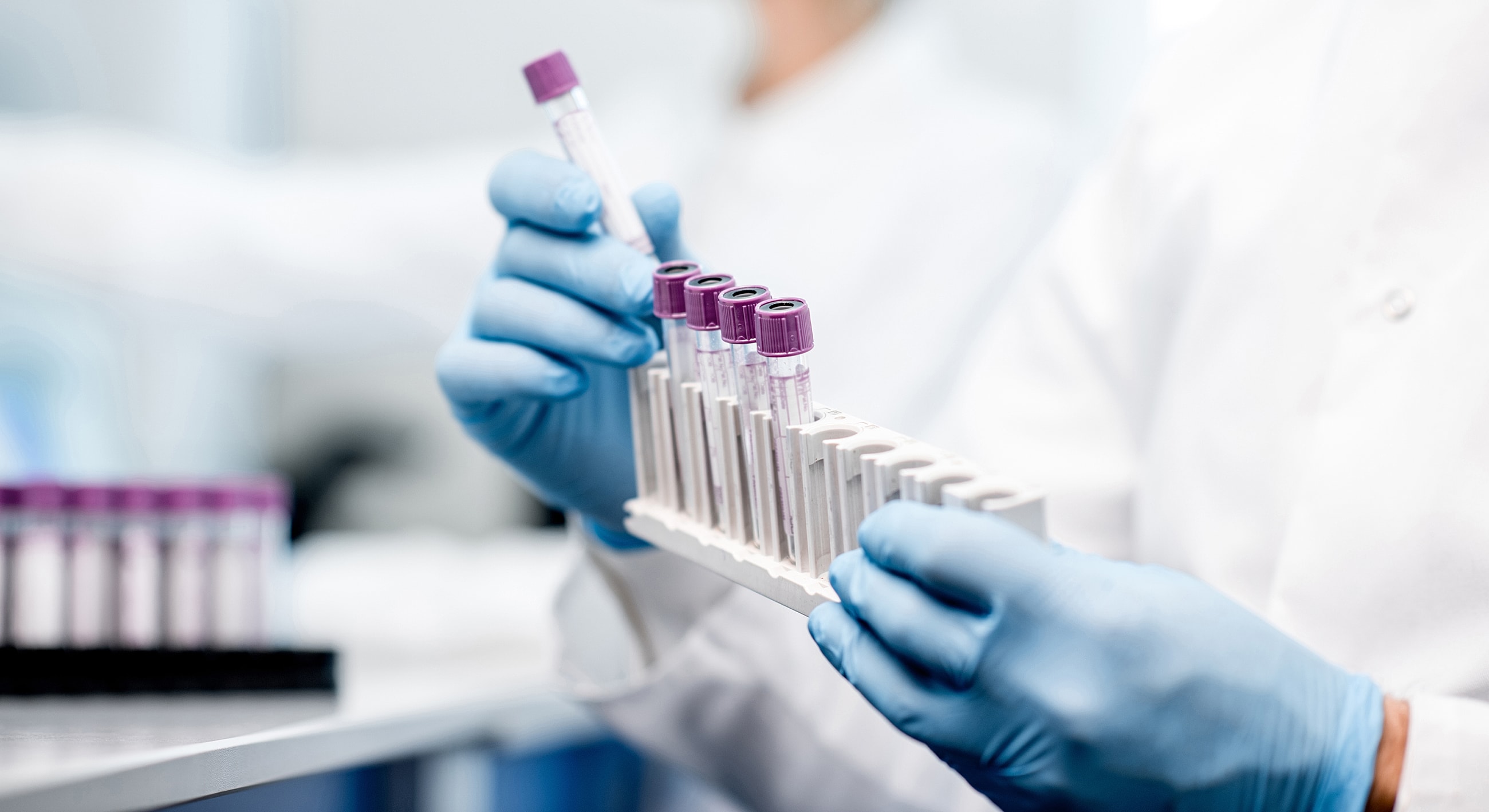 Laboratory technician holding test tubes in gloves.
